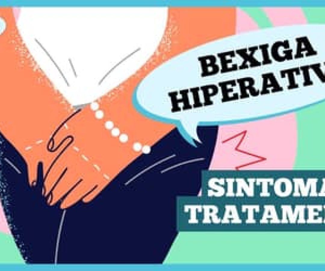 Bexigahiperativaquaisossintomaseotratamento_0348871001763348232.jpeg